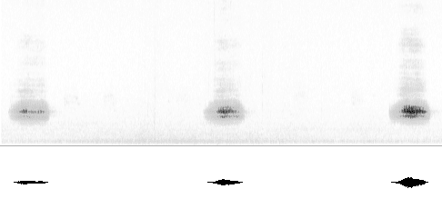 Sonogram av sang